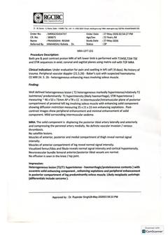 MRA left leg: report (RGCIRC)
