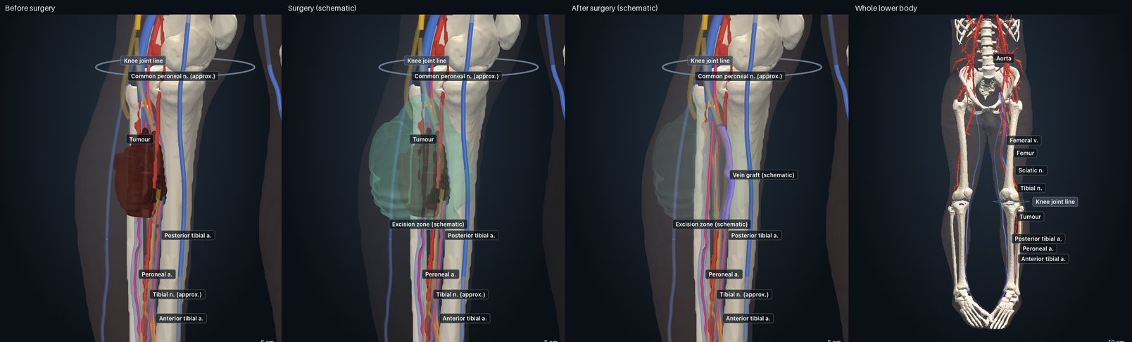 Static views of the AI-generated 3D reconstruction: before, surgery and after