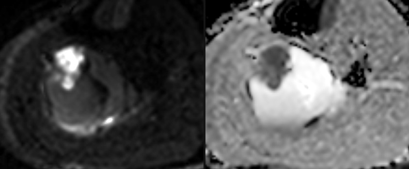Diffusion at the solid-component level